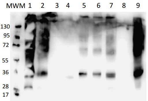 western blot using anti-PIP global antibodies